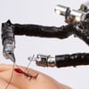 Компания Vicarious Surgical создала миниатюрного робота для операций. Как он может совершить революцию в хирургии