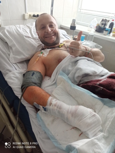 Втративши ліву стопу на полі бою, Сергій Позняк вже пройшов протезування і реабілітацію у США та повертається до України /з особистого архіву