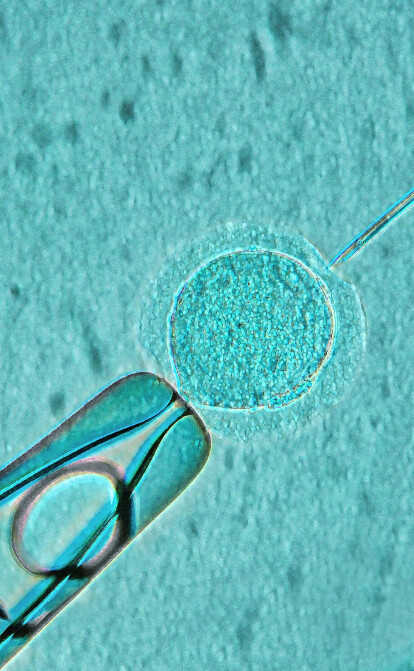 Происхождение жизни. Как работает технология искусственного оплодотворения