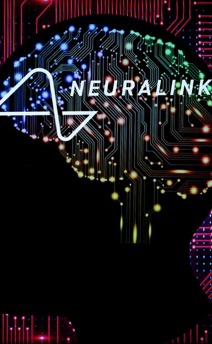 Ілон Маск озвучив перші результати вживження імпланту Neuralink людині /Getty Images